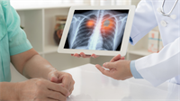 Cost-effectiveness of first-line afatinib versus osimertinib in non-small cell lung cancer with EGFR mutation in Vietnam